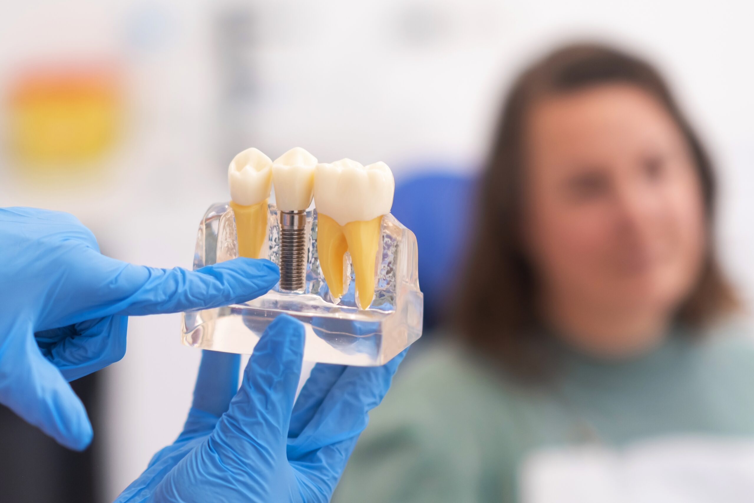Dental implants, the dentist discusses a plan with a patient